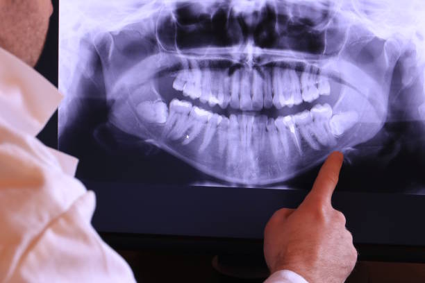 Best Same-Day Emergency Dentist in Asbury Lake, FL