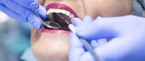Best Emergency Treatment for Toothache in Asbury Lake, FL